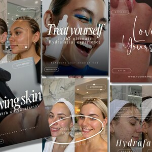 May include: A collage of images promoting a hydrafacial treatment. The images include before and after photos, a woman holding a product, and text that reads "Treat yourself to the ultimate Hydrafacial experience" and "Glowing skin starts with a hydrafacial."