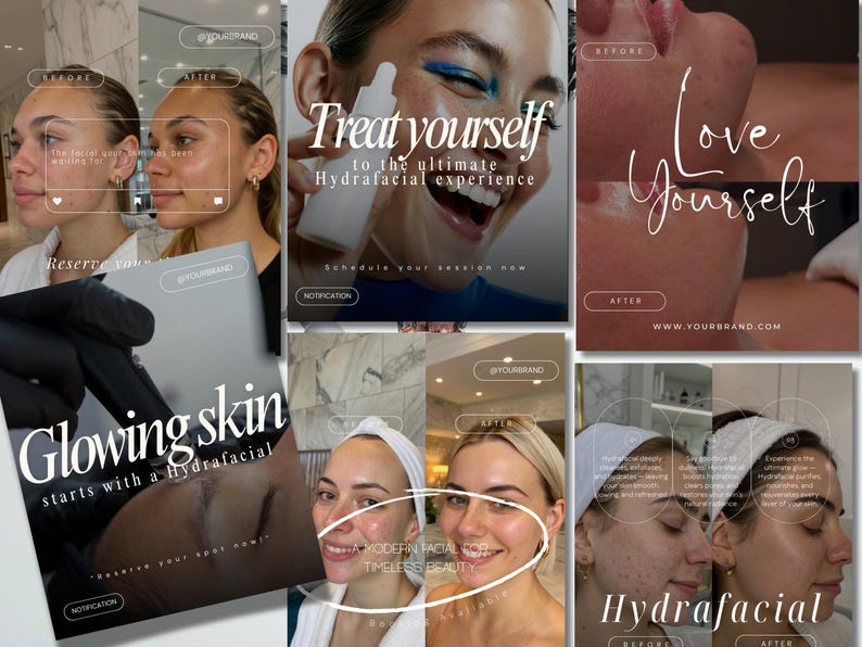 May include: A collage of images promoting a hydrafacial treatment. The images include before and after photos, a woman holding a product, and text that reads "Treat yourself to the ultimate Hydrafacial experience" and "Glowing skin starts with a hydrafacial."