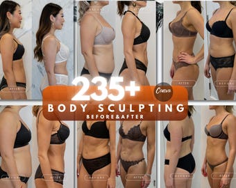Body Contouring Instagram Templates | 235 Before & After Posts | Body Sculpting Social Media | Medspa Marketing | Luxury Beauty Instagram