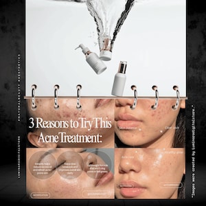 May include: A promotional graphic for an acne treatment featuring three white skincare bottles with rose gold caps above water splashes. The text reads 3 Reasons to Try This Acne Treatment, highlighting skin balance, clarity, and a healthy glow.