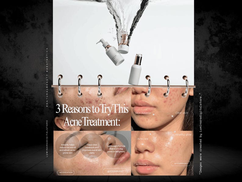 May include: A promotional graphic for an acne treatment featuring three white skincare bottles with rose gold caps above water splashes. The text reads 3 Reasons to Try This Acne Treatment, highlighting skin balance, clarity, and a healthy glow.