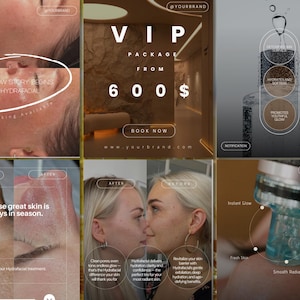 May include: A collage of images promoting a skincare service. The images include before and after photos, text that reads "Your glow story begins with Hydrafacial" and "Because great skin is always in season."