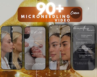 Microneedling Instagram Reels Bundle | RF & Facial Treatment Video Templates | Esthetician Canva Posts