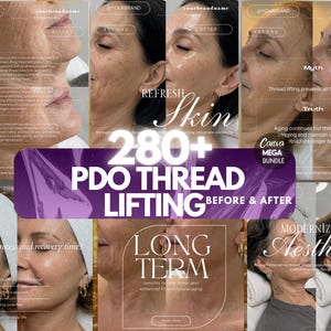 Peut inclure: Image promotionnelle présentant des photos avant et après des traitements de lifting par fils tenseurs PDO. Le texte comprend "Refresh Skin" et "280+ PDO Thread Lifting Before & After". L'image promeut les services esthétiques.