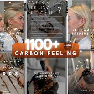 Könnte beinhalten: Eine Collage, die Carbon-Peeling-Behandlungen bewirbt. Die Bilder zeigen Vorher-Nachher-Fotos, Pflegehinweise und Werbetexte wie "Lass deine Haut wieder atmen" und "Mitesserentfernung schön gemacht".
