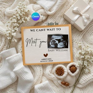 Custom Baby Reveal Digital Pregnancy Announcement Template Personalized pregnancy announcement  digital picture baby scan announcements card