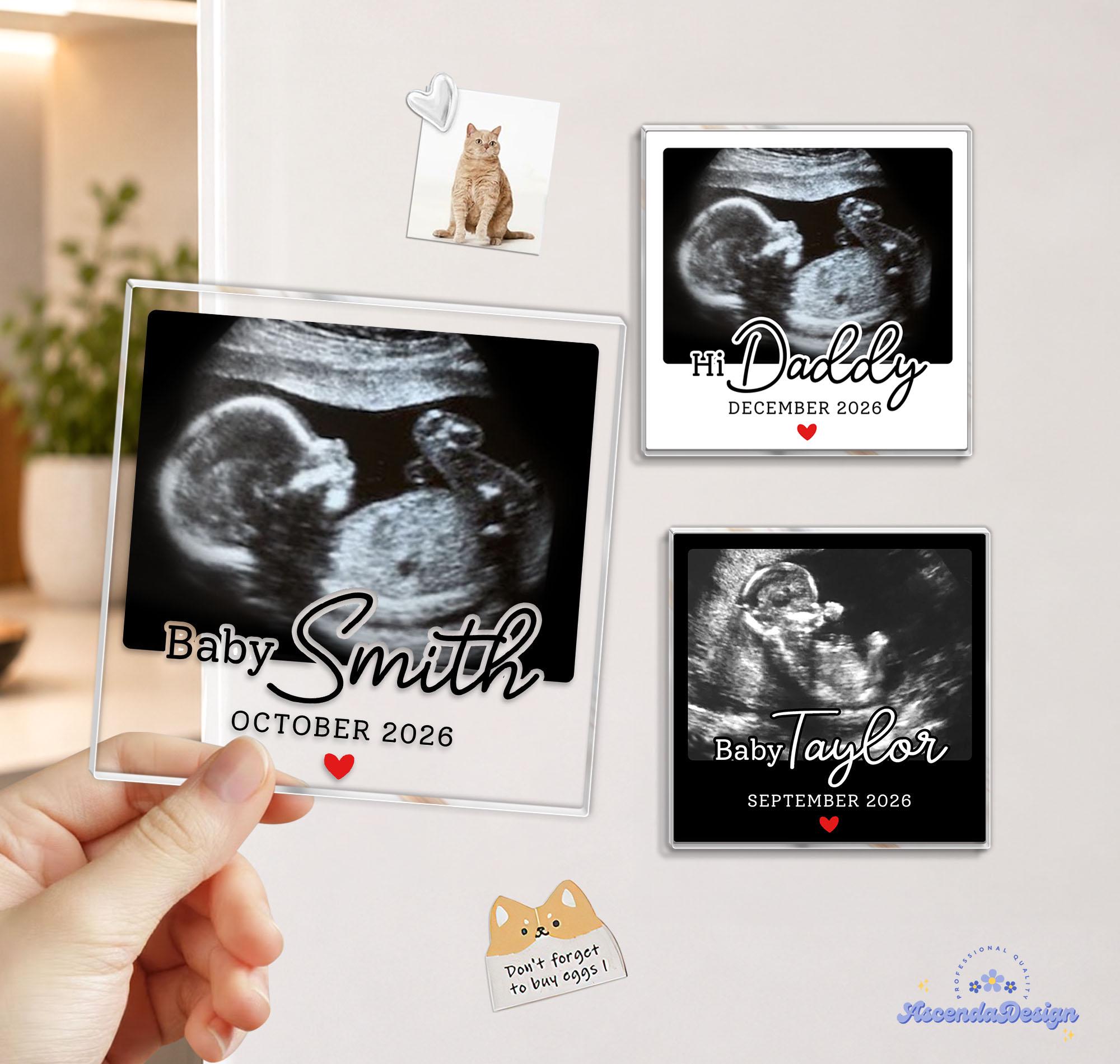 Sonogram Magnets Custom Baby Ultrasound Photo Magnet, Personalized Baby Announcement ...