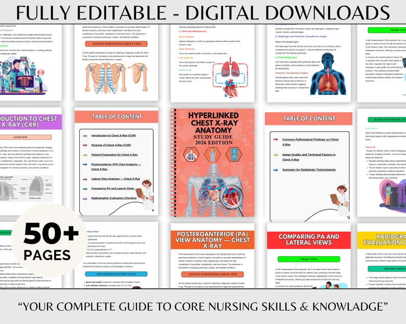 Chest X-ray Anatomy Study Guide , X Ray Positioning Guide , X RAY ...