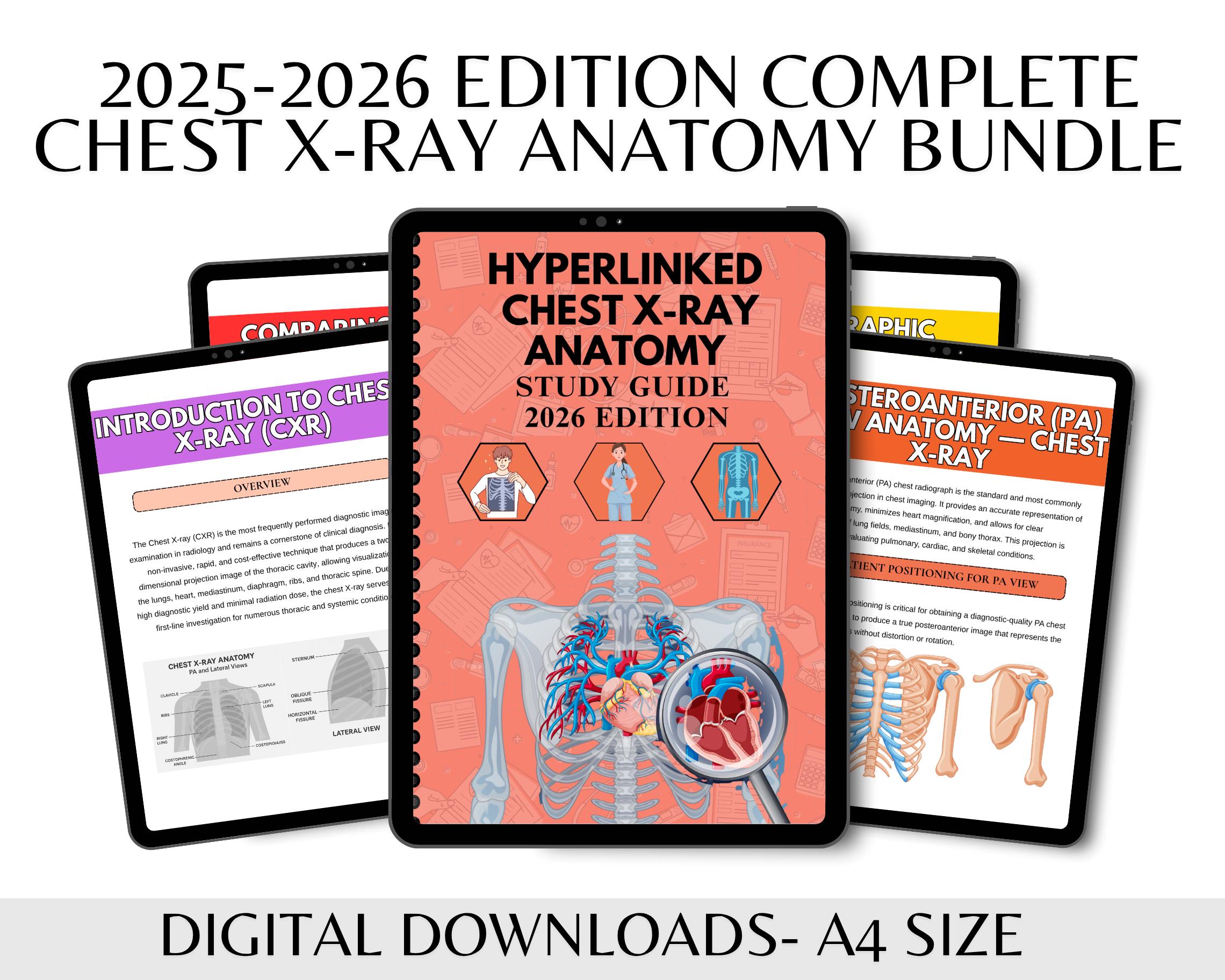 Chest X-ray Anatomy Study Guide , X Ray Positioning Guide , X RAY ...