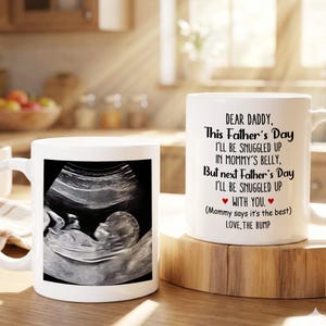 May include: Two white ceramic mugs. One mug displays a grayscale ultrasound image. The other mug has text that reads "DEAR DADDY, This Father's Day I'LL BE SNUGGLED UP IN MOMMY'S BELLY, But next Father's Day I'LL BE SNUGGLED UP WITH YOU. LOVE, THE BUMP."