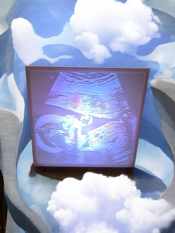 custom lithophane ultra sound