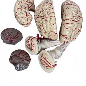 Puede incluir: Un modelo anatómico de cerebro humano que consta de varios segmentos desmontables. El modelo presenta una superficie de color crema con vasos sanguíneos pintados en rojo detallados en la corteza cerebral, el cerebelo y el tronco encefálico.