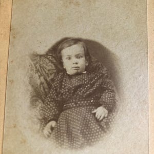 Antique Photo CDV Carte De Viste Post Mortem Open Eyes Child Lying Back