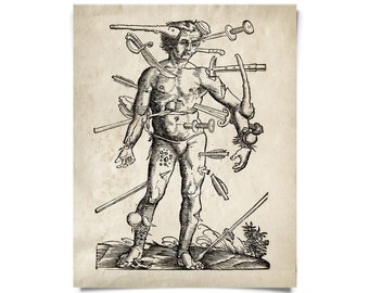 Vintage Anatomy Wounded Man Print w/ optional frame / High Quality Giclee Print