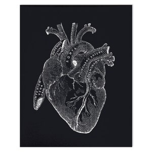 Vintage Anatomy Heart Diagram Black Print W/ Optional Frame / - Etsy