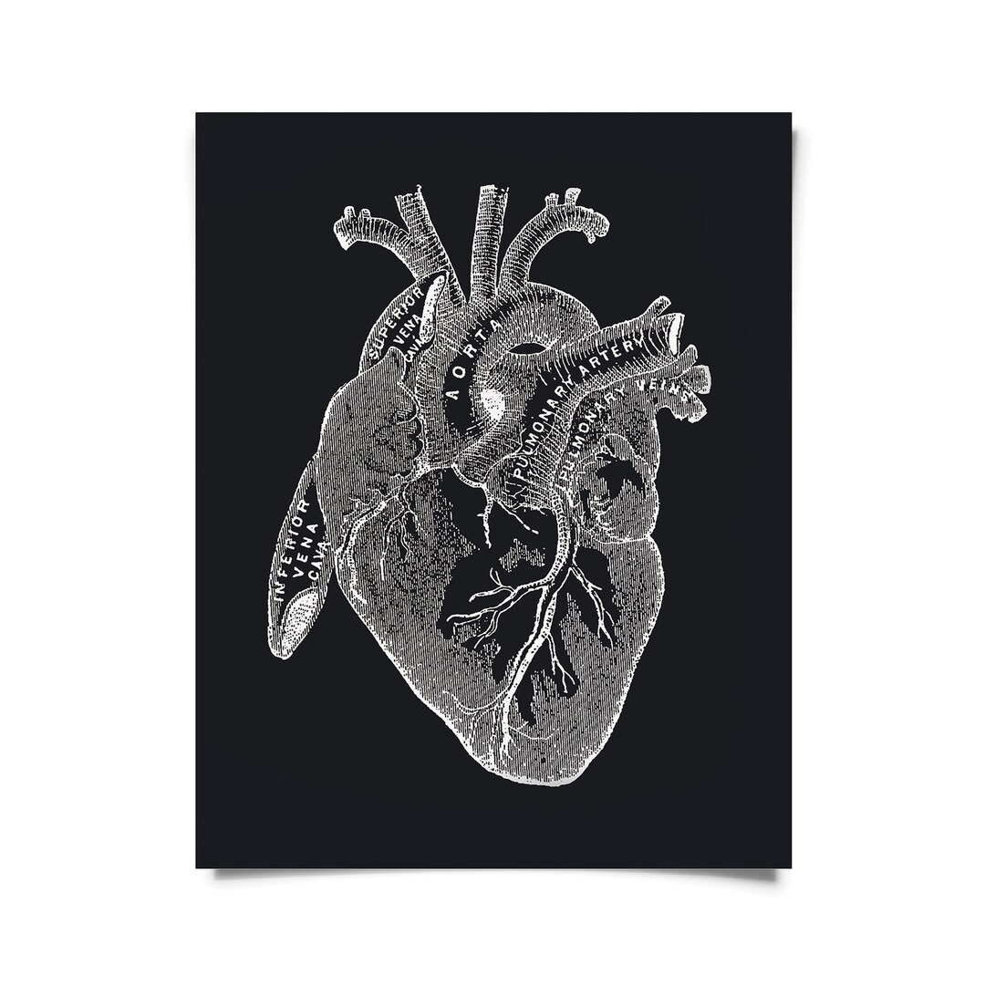 Vintage Anatomy Heart Diagram Black Print W/ Optional Frame / High ...