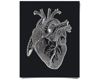 Vintage Anatomy Heart Diagram Black Print w/ optional frame / High Quality Giclee Print