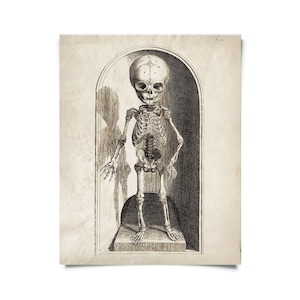 May include: A black and white illustration of a human skeleton, standing upright in a glass case. The skeleton is that of a baby, with a large head and small body.