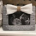 New Grandparent Gift | Pregnancy Baby Announcement | Worth The Wait Custom Picture Frame Gift | New Baby Frame Pregnant Baby Ultrasound