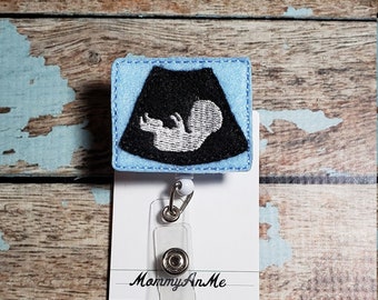 Sonogram Badge Reel, Ultrasound Badge Reel, Retractable ID Badge Holder, Baby Badge Reel, Nurse Badge Reel, Hospital ID Reel