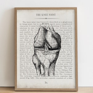 Vintage Knee Anatomy Art Print: Gift for Physical Therapist