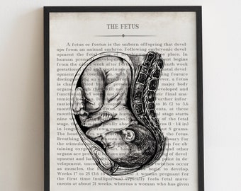 Fetus In Utero Art Print, Gift for OBGYN, Obstetrics Nurse Gift, OB/GYN Graduation Gift, Pregnancy Anatomy, Baby In Womb Illustration