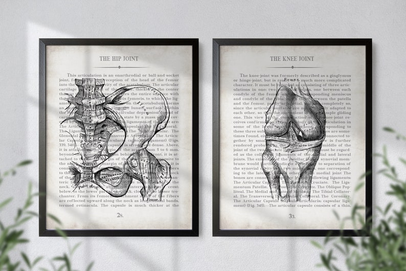 Orthopedic Gift Hip and Knee Vintage Anatomy Art Print Set of 2 Orthopedic Surgeon Graduation Gift & Office Decor image 7