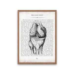 Hip and Knee Vintage Anatomy Art Print Set of 2 Orthopedic Surgeon Physical Therapy Physical Therapist Gift image 3