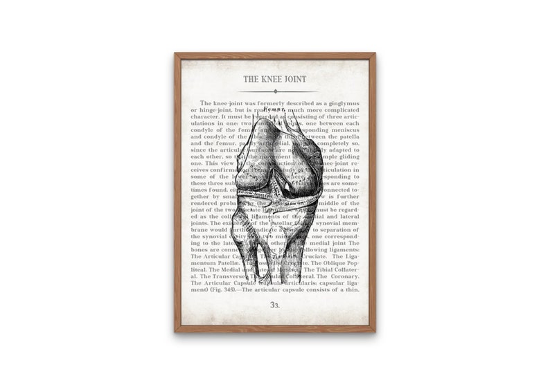 Hip and Knee Vintage Anatomy Art Print Set of 2 Orthopedic Surgeon Physical Therapy Physical Therapist Gift image 3