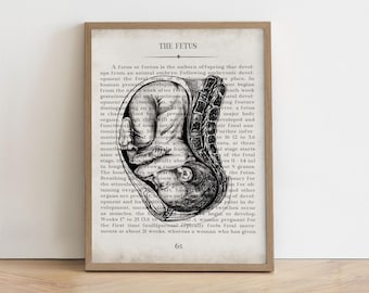 Fetus Art Print for OBGYN Office Decor Obstetrics Gynecologist Gift Labor and Delivery Nurse Midwife Appreciation