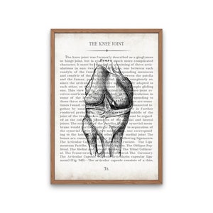 Orthopedic Gift Hip and Knee Vintage Anatomy Art Print Set of 2 Orthopedic Surgeon Graduation Gift & Office Decor image 3