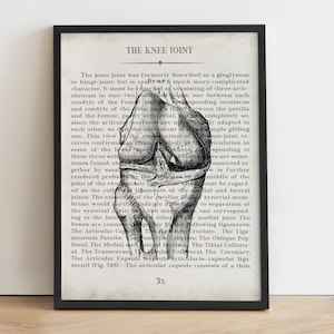 Vintage Knee Anatomy Art Print: Medical Office Decor
