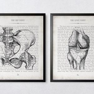 Orthopedic Gift Hip and Knee Vintage Anatomy Art Print Set of 2 Orthopedic Surgeon Graduation Gift & Office Decor image 1