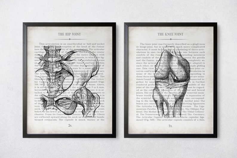 Hip and Knee Vintage Anatomy Art Print Set of 2 Orthopedic Surgeon Physical Therapy Physical Therapist Gift image 6