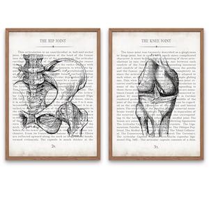 Vintage Hip and Knee Anatomy Art Print Set: Orthopedic Gift