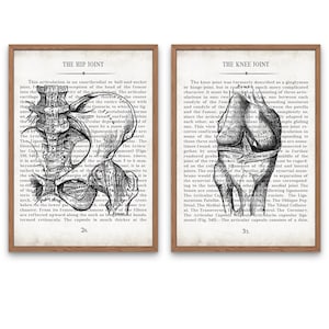 Hip and Knee Vintage Anatomy Art Print Set of 2 Orthopedic Surgeon Physical Therapy Physical Therapist Gift image 1