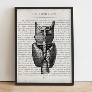 Thyroid Anatomy Art - Cancer Survivor  Doctor Gift - Graduation Print
