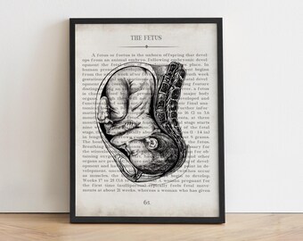 Utero Fetus Art Print - OBGYN Nurse - Pregnancy Illustration - Womb Baby Anatomy, Graduation Gift