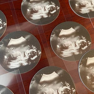Ultrasound Edible Images | Custom Edible Images | Baby Shower Cupcake Toppers | Cookie toppers | Edible Toppers | Any Theme Available
