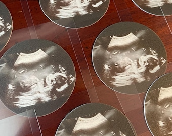 May include: Multiple circular stickers featuring a black and white ultrasound scan of a fetus. Each sticker displays the same medical imaging showing the profile of a developing baby, arranged in a grid pattern on a smooth, dark brown surface.