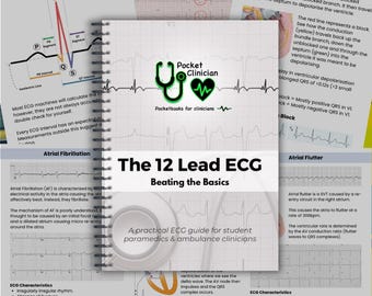 ECG Pocketbook – 12-Lead ECG Interpretation for Student Paramedics