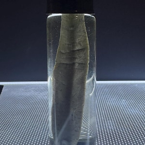 Pode incluir: Um frasco de vidro transparente com uma tampa preta contém um espécime cinza-marrom preservado. A amostra parece ser uma amostra biológica, possivelmente um tecido ou órgão, suspenso em um líquido transparente. O frasco está em uma superfície texturizada.