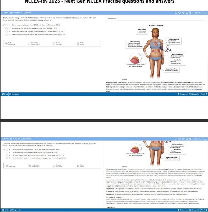 Ace the 2025 Next Gen NCLEX-RN: Comprehensive Practice Questions ...