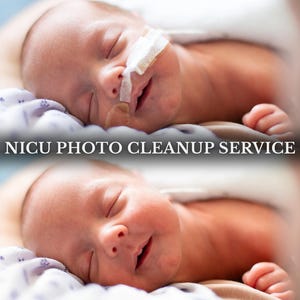 Puede incluir: Dos imágenes de un bebé recién nacido con los ojos cerrados, descansando sobre una superficie suave. El bebé tiene un pequeño tubo cerca de la nariz. El texto "NICU PHOTO CLEANUP SERVICE" se muestra en letras blancas.