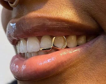 Custom Open-Face Window Tip Cap Grillz – Gold or Sterling Silver – Any Tooth + FREE Mould Kit!