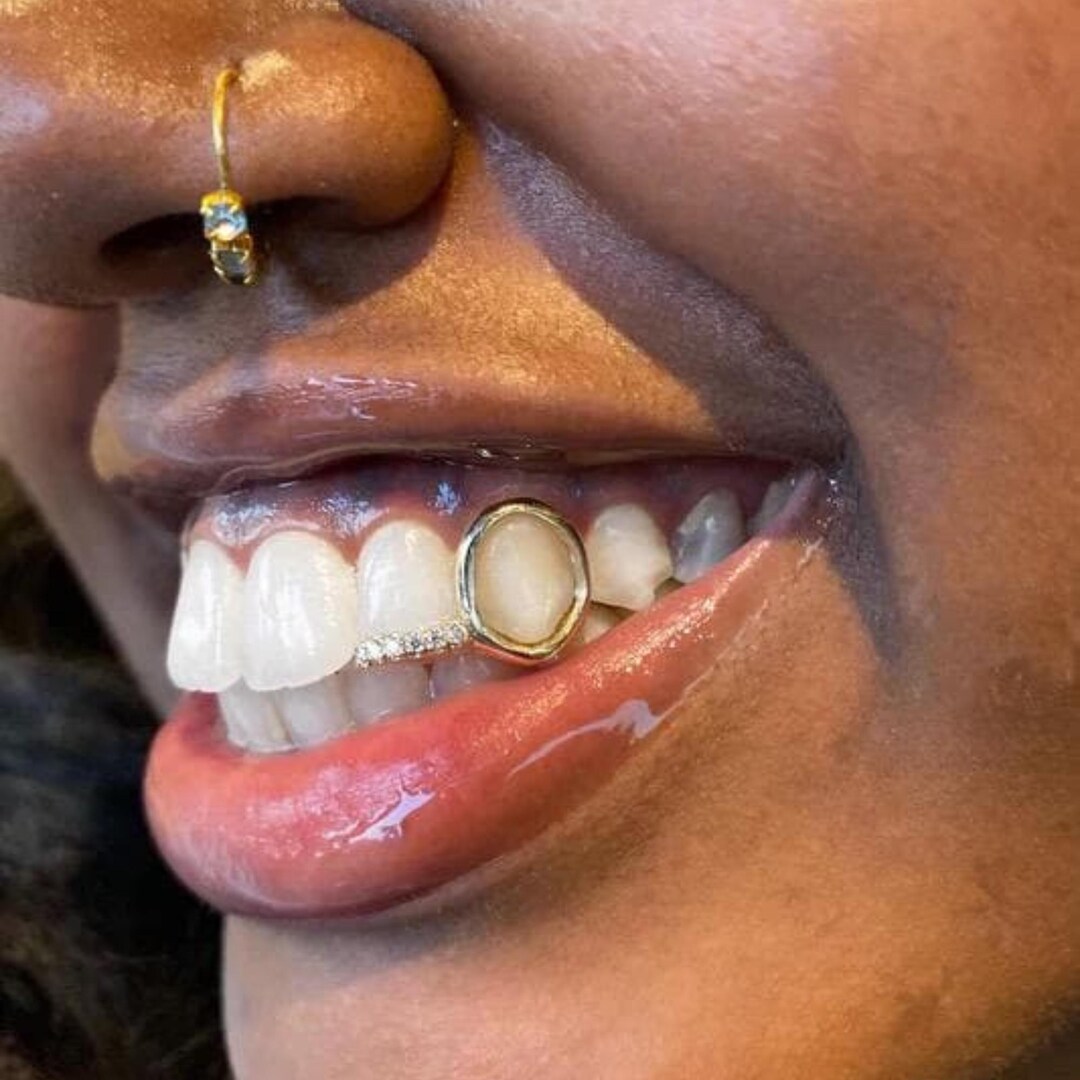 Custom Iced Out Diamond Open-face Window Tip Cap Grillz - Gold or ...
