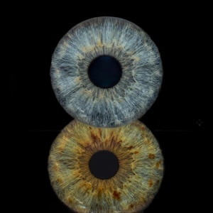 May include: A high-resolution macro view of two human irises stacked vertically. The top iris is a cool blue with intricate white radial fibres, while the bottom iris is a warm hazel-brown with golden-brown flecks and a dark central pupil.