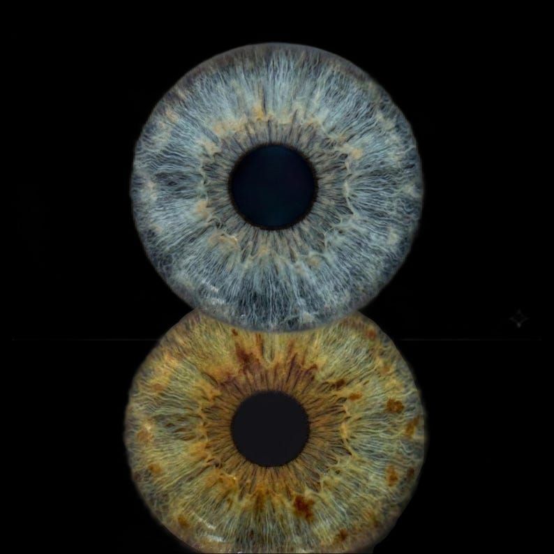 May include: A high-resolution macro view of two human irises stacked vertically. The top iris is a cool blue with intricate white radial fibres, while the bottom iris is a warm hazel-brown with golden-brown flecks and a dark central pupil.