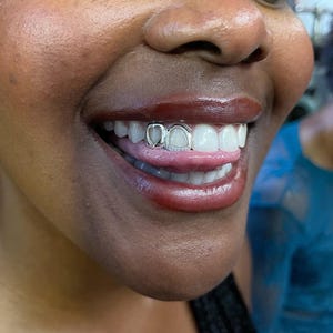 Heart Open Face Window Iced Out Diamond Tip Cap– Custom Made Gold & Silver Grillz | Personalized Grillz Sets FREE Mold Kit + Free Shipping!
