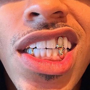 Classic Plain Gold Caps (2 Teeth)– Custom Made 10K, 18K Gold Grillz | Personalized Grillz Sets FREE Mold Kit + Free Shipping!